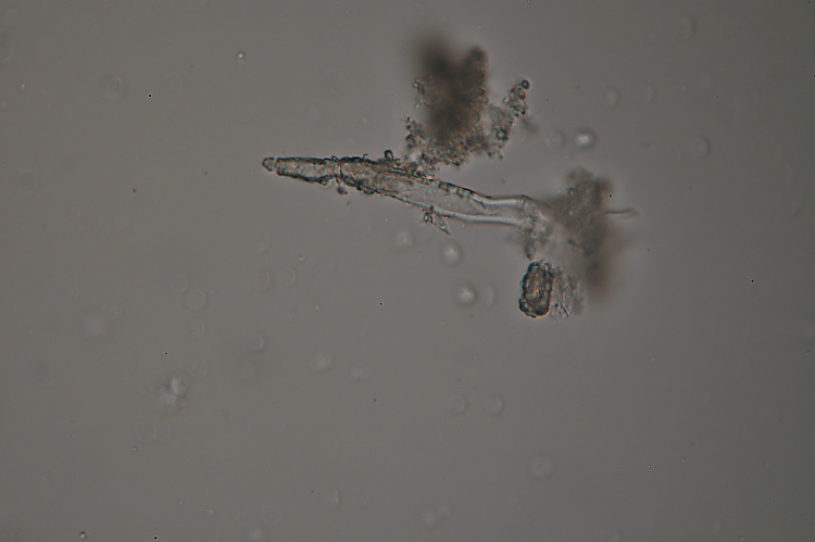 Sullo stesso tronco (Phlebiopsis ravenelii)